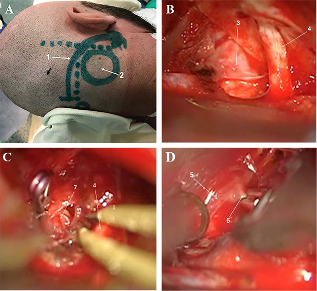 Интраоперационные фотографии