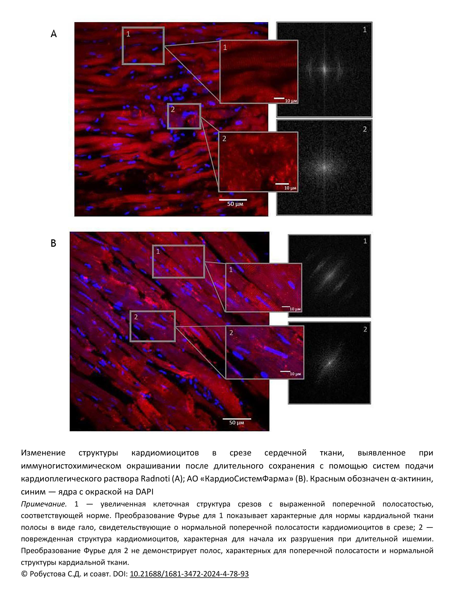 Изменение структуры кардиомиоцитов в срезе сердечной ткани, выявленное при иммуногистохимическом окрашивании после длительного сохранения